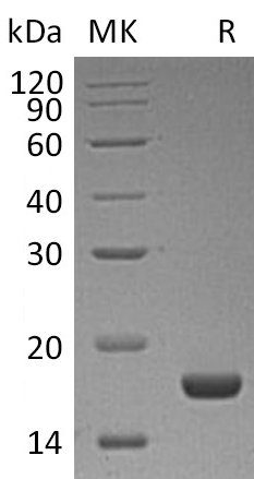 Recombinant Human PLA2G1B (C-6His)