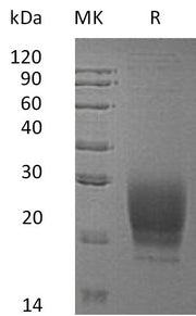 Recombinant Human PRND (C-6His)