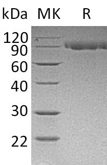 Recombinant Mouse Serpin G1 (C-6His)
