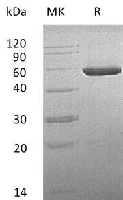Recombinant Mouse CNDP2 (C-6His)