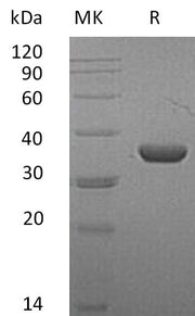 Recombinant Mouse LDHA (C-6His)