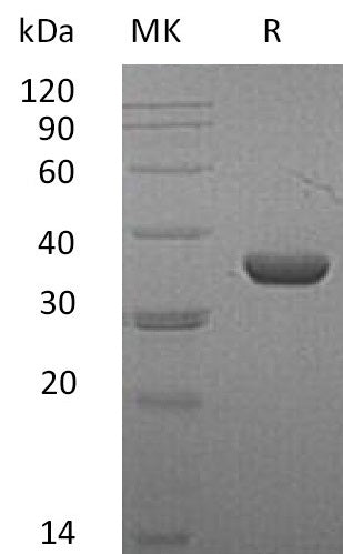Recombinant Mouse LDHA (C-6His)