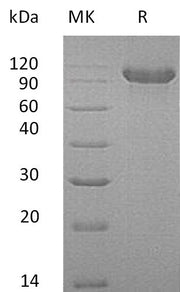 Recombinant Human CDH16 (C-6His)
