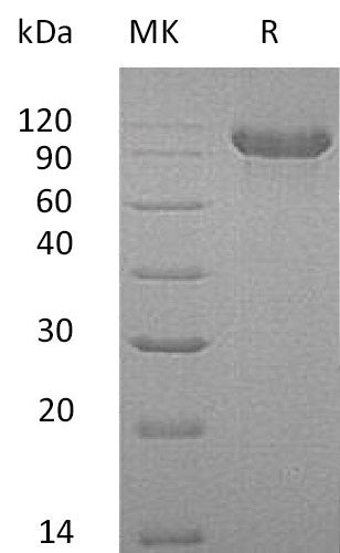 Recombinant Human CDH16 (C-6His)