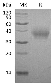 Recombinant Rabbit B7-1 (C-6His)