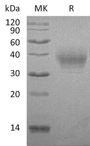 Recombinant Rabbit B7-1 (C-6His)