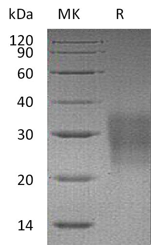 Recombinant Mouse Fas (C-6His)