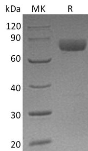 Recombinant Human Mesothelin (C-Fc)