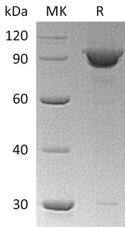 Recombinant Human KPNB1 (N-6His)