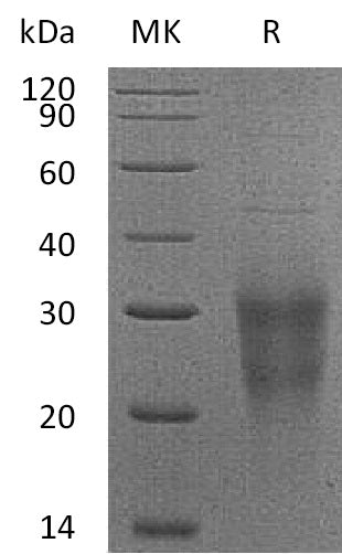 Recombinant Human NKG2D (N-6His)