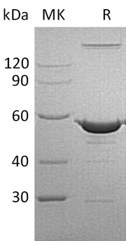Recombinant Human NAMPT (N-6His)