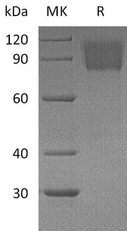 Recombinant Mouse PDGFRA (C-6His)