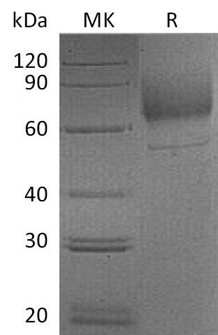 Recombinant Mouse LIMPII (C-6His)