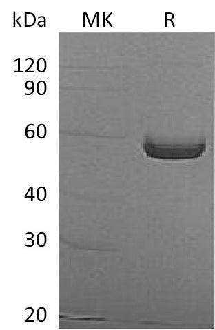 Recombinant Human ALDH1A3 (N-6His)