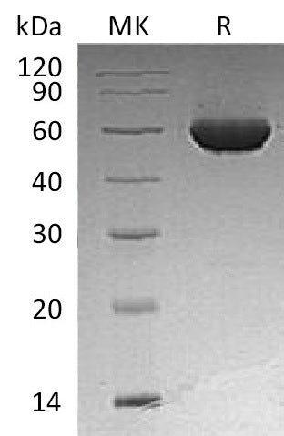 Recombinant Human ALDH1A2 (N-6His)