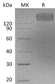 Recombinant Human CEACAM5 (C-Fc)