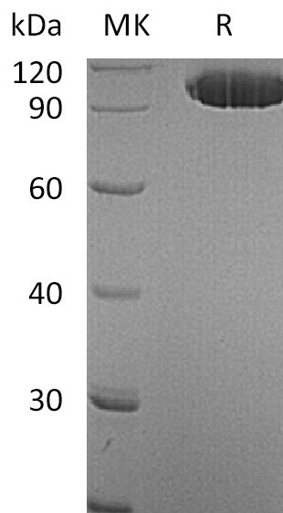 Recombinant Human EphA2 (C-Fc)