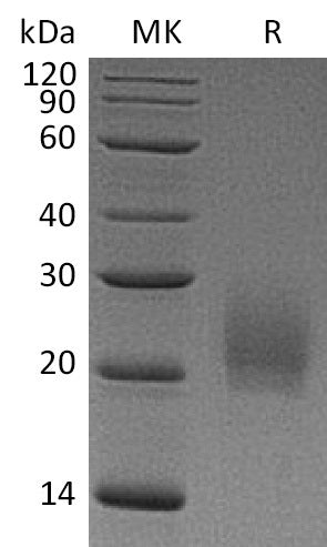 Recombinant Mouse CTLA-4 (C-6His)