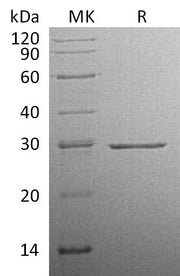 Recombinant Human CFD (C-10His)