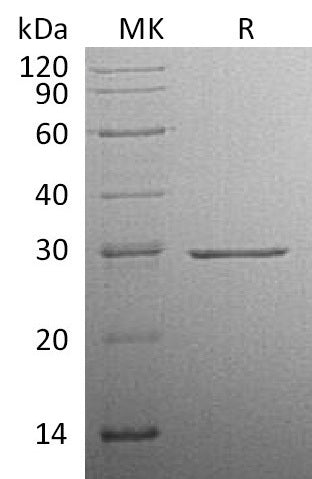 Recombinant Human CFD (C-10His)