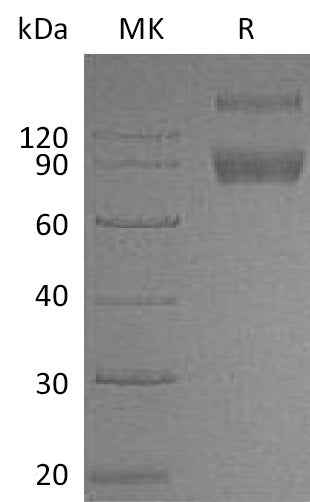 Recombinant Mouse IL-1R2 (C-Fc)