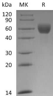 Recombinant Mouse Fetuin A (C-10His)