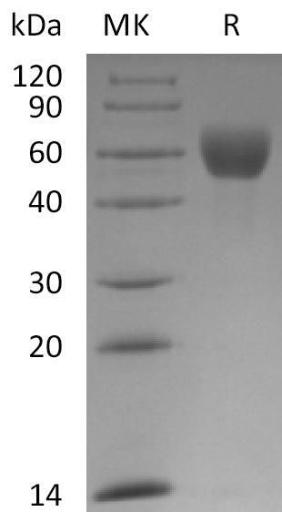 Recombinant Mouse Fetuin A (C-10His)