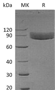 Recombinant Human IL-1R1 (C-Fc)