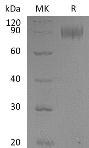 Recombinant Mouse IL-1R1 (C-Fc)