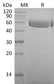 Recombinant Macaca mulatta Fetuin A (C-10His)