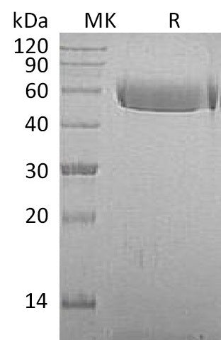 Recombinant Macaca mulatta Fetuin A (C-10His)