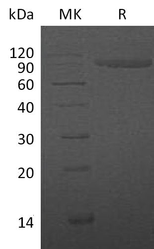 Recombinant Human IL-1R2 (C-Fc)