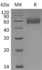Recombinant Human IL-1R2 (C-6His)