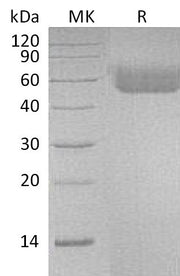 Recombinant Human IL-1R1 (C-6His)
