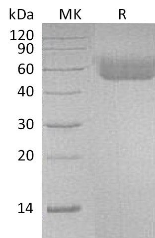 Recombinant Human IL-1R1 (C-6His)