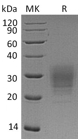 Recombinant Human VSTM1 (C-6His)