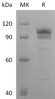 Recombinant Human EphB2 (C-Fc)