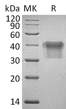 Recombinant Human IL-2RA (C-6His)