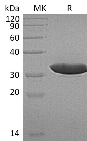 Recombinant Human ECH1 (N-6His)