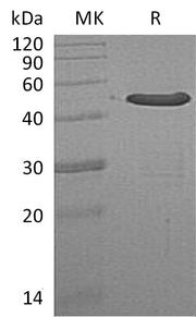 Recombinant Human NTAQ1 (N-GST)
