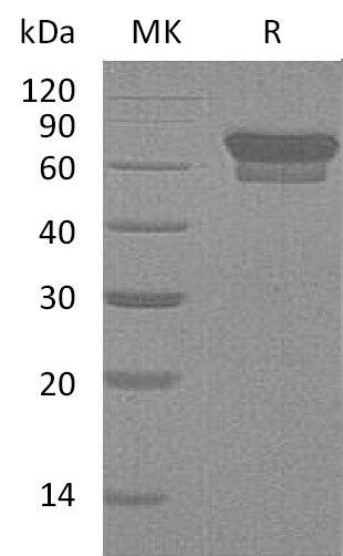 Recombinant Mouse PD-1 (C-Fc)