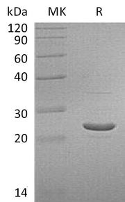 Recombinant Human GSTP1