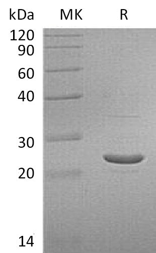 Recombinant Human GSTP1
