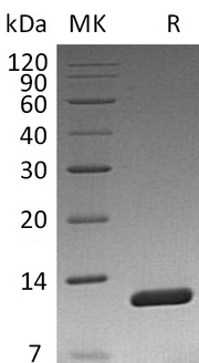 Recombinant Vibriocholerae Toxin B