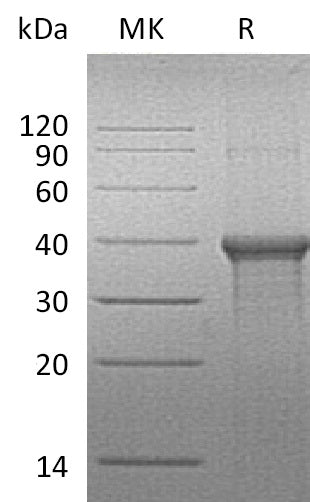 Recombinant Human BLVRA (C-6His)