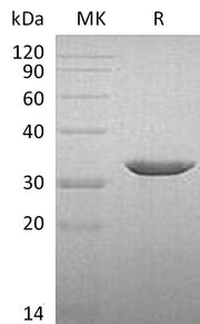 Recombinant Human B3GAT3 (C-6His)