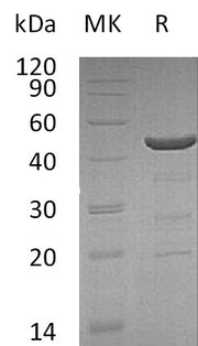 Recombinant Human NCF1 (C-6His)