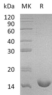 Recombinant Mouse IL-16 (N-6His)