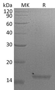 Recombinant Mouse IL-21