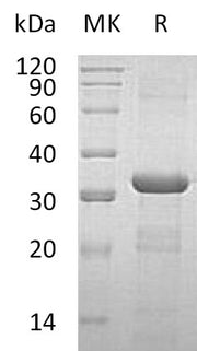Recombinant Human CORO6 (N-6His)